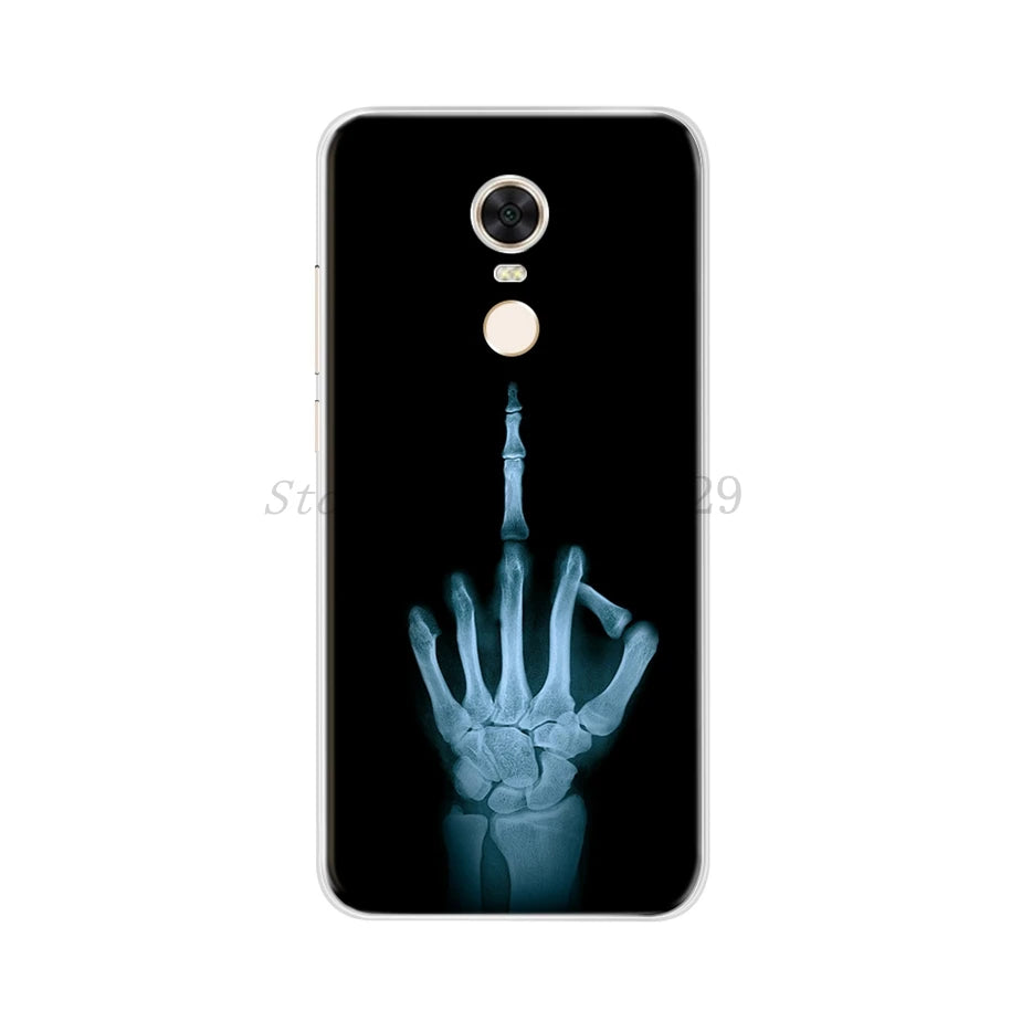 For Xiaomi Redmi 5 Plus Case Silicone Full Protective Cover Soft TPU Phone Case For Xiaomi Redmi 5 Case For Redmi5 5 Plus Fundas